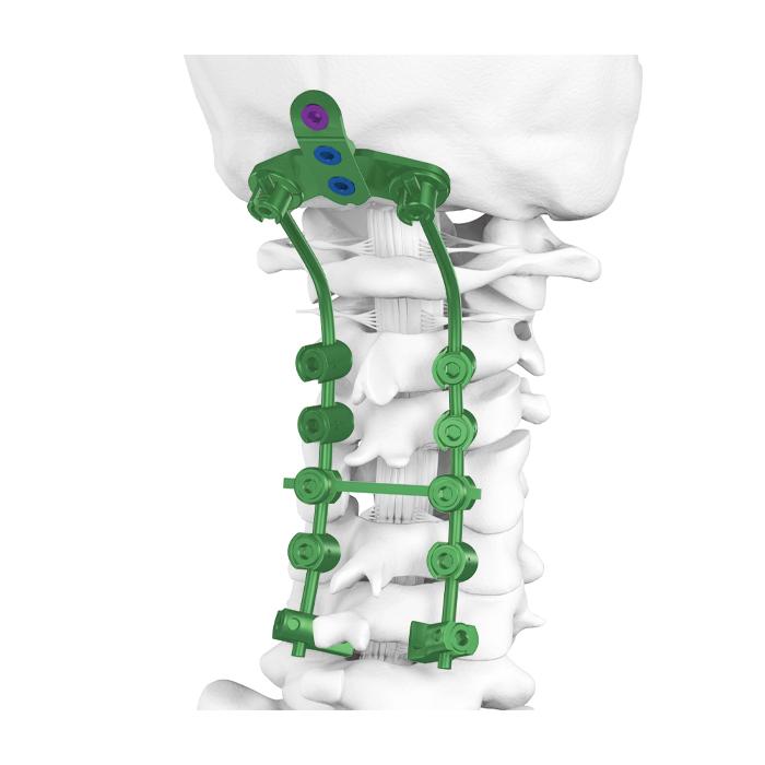 Occipito-Cervico-Thoracic (OCT) Spine System