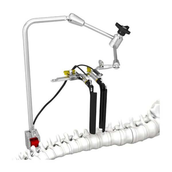 Conjunto de Instrumentos do Sistema de Acesso Anterolateral da Coluna MIS