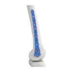 Placa de Bloqueio Femoral Distal VAL