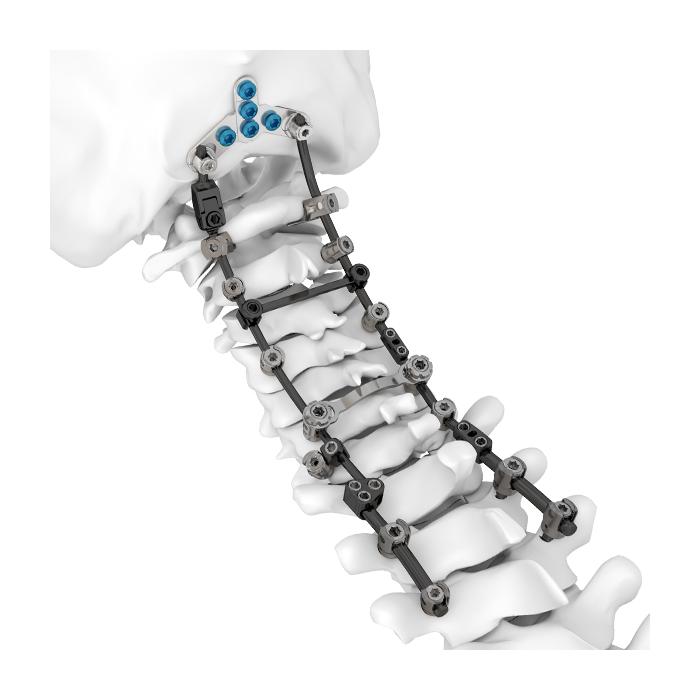 Sistema de Posterior da Coluna Cervical HOBBIT 3,5/4,0
